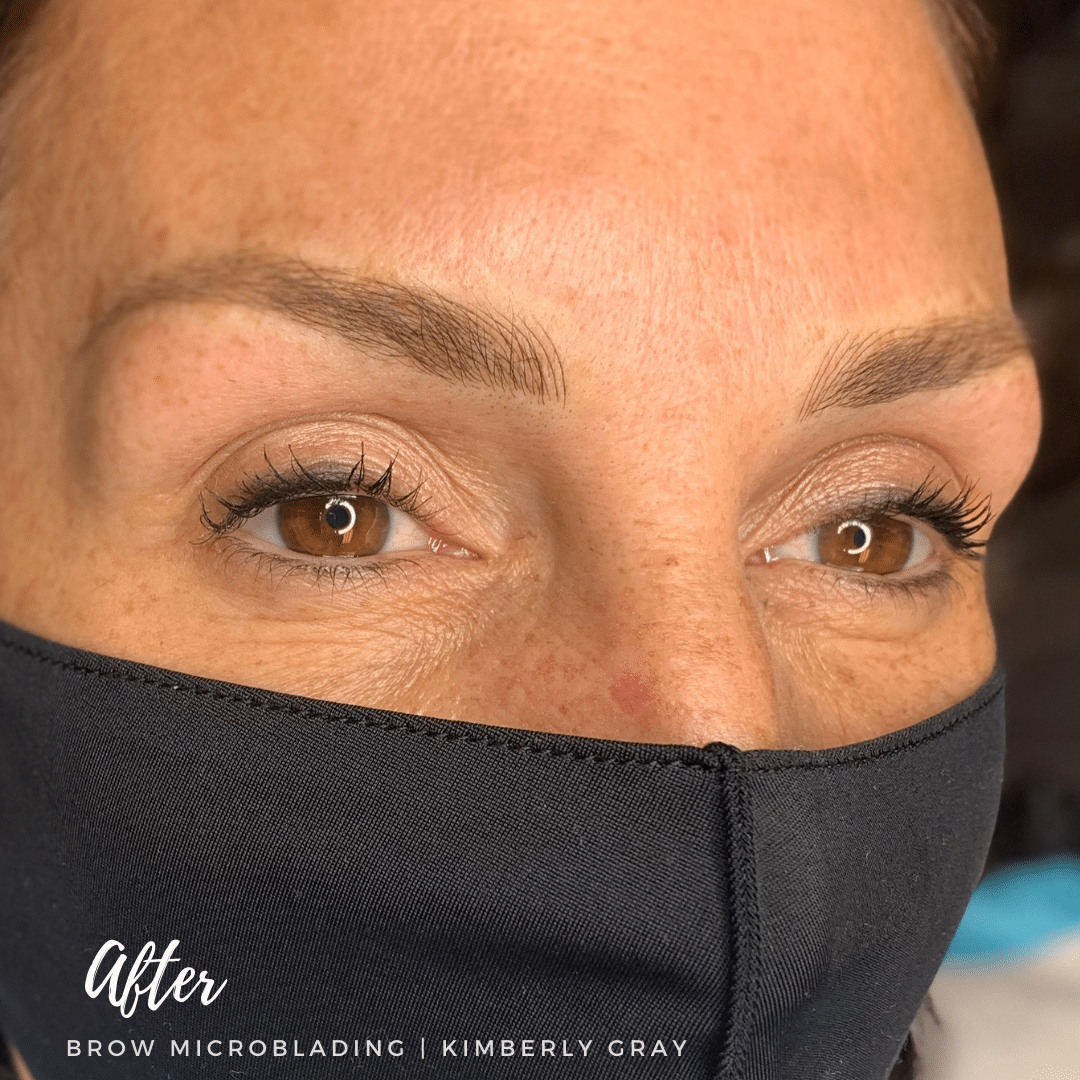 After Microblading