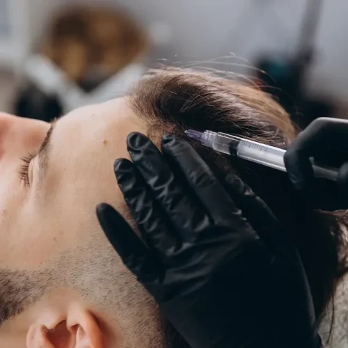 hairloss-men copy Hair Loss for men