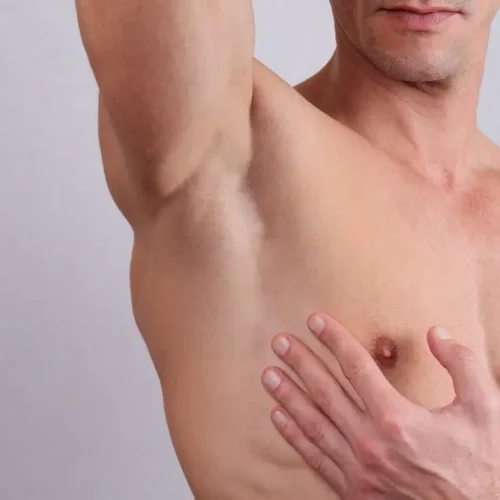 laser-hair-removal-men laser-hair-removal-men